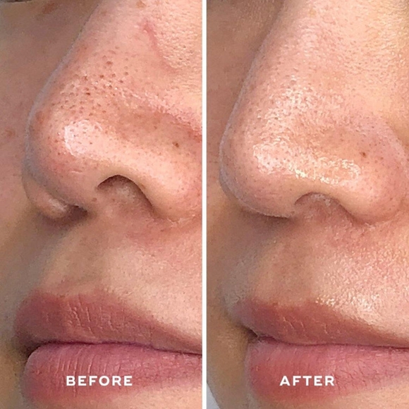 The Aceology Detoxifying Treatment Mask 2.4oz - Picture 2 of 3